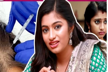 முடி வளரத்துக்கு ஊசி போட்டேன் | Raja Rani 2 Archana Interview