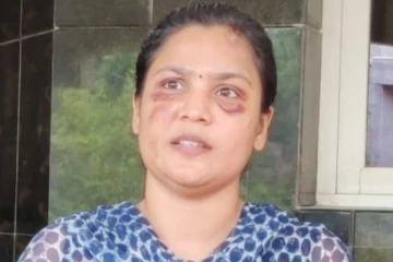 துணை நடிகைக்கு மாமனார் பாலியல் தொல்லை - உருட்டுக்கட்டையால் தாக்கப்பட்டதாக பரபரப்பு புகார்..!