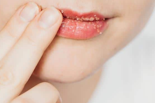 கருப்பான உதடுகளை இளஞ்சிவப்பாக மாற்ற உதவும் எளிய வீட்டு வைத்தியம் | Home Remedies To Get Rid Of Dark Lips In Tamil கருப்பான உதடுகளை இளஞ்சிவப்பாக மாற்ற உதவும் எளிய வீட்டு வைத்தியம் | Home Remedies To Get Rid Of Dark Lips In Tamil