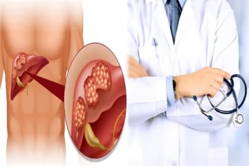 கல்லீரல் புற்றுநோய் ஏற்பட காரணம் என்ன? மருத்துவரின் கூற்று