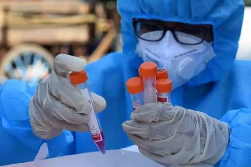 உலகளவில் கொரோனா பாதித்தவர்கள் எண்ணிக்கை 55 சதவீதம் உயர்வு