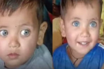 ஆடை நிறத்திற்கு ஏற்றவாறு நிறம் மாறும் கண்கள்.. அதிசய குழந்தை -இந்தியாவில் எங்கு தெரியுமா?