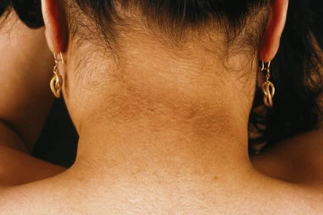 கருப்பான கழுத்தை சில நிமிடங்களிலேயே வெள்ளையாக்கலாம்: எப்படி தெரியுமா?