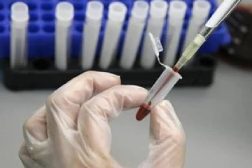 தென்னாபிரிக்காவில் பெண் ஒருவரது உடலில் 32 முறை உருமாறியக் கொரோனா