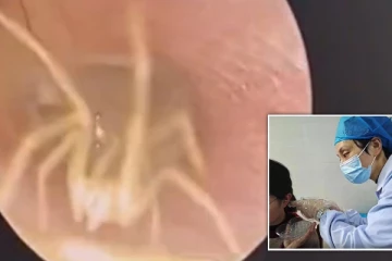 காதுக்குள் கேட்ட விசித்திர சத்தம்!  மருத்துவ பரிசோதனையில் வெளியான உண்மை.. இளம்பெண்ணுக்கு காத்திருந்த அதிர்ச்சி