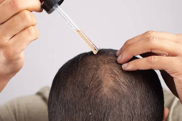 வழுக்கை தலையில் முடி வளர வைக்கும் ஸ்கால்ப் மசாஜ்! எப்படி செய்வது? | Scalp Massage With Oil For Hair Regrowth