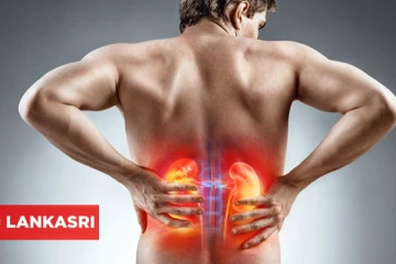 அடிக்கடி சிறுநீரக கற்கள் உருவாக இவைகளால் தான் காரணம்... எச்சரிக்கையாக இருங்க