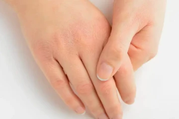 ශ්‍රී ලංකා ජනගහනයෙන් 50%කට පමණ පවතින ඌනතාවයක් ගැන සෞඛ්‍ය අමාත්‍යාංශයෙන් අනතුරු ඇගවීමක්