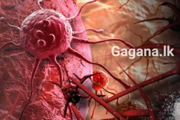 පැතිර යන වෛරසය ගැන වසංගත රෝග විද්‍යා අංශයෙන් දැනුම්දීමක්..