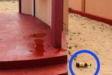 யாழில் இடம்பெற்ற மோதலில் முன்னாள் வேட்பாளர் மருத்துவமனையில்