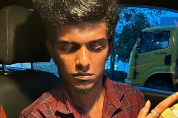 KPY பாலா விரல் உடைந்தது.. நடிகர் வெளியிட்ட அதிர்ச்சி போட்டோ