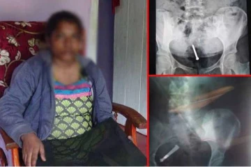 சவூதி அரேபியாவில் இலங்கை பெண்ணுக்கு நேர்ந்த கொடுமை!