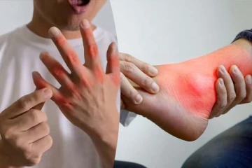 யூரிக் அமில பிரச்சனையால் அவதியா? இந்த உணவுகளை எடுத்துக்கோங்க