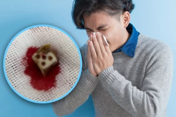 20 ஆண்டுகளாக தும்மலால் அவதிப்பட்ட இளைஞர் ; மருத்துவர்கள் அதிர்ச்சி