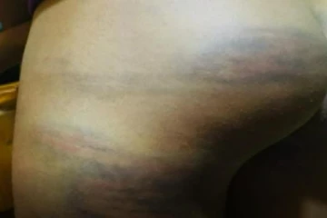 கடுமையாகத் தாக்கப்பட்ட மாணவன் -  தலைமறைவாகியுள்ள அதிபர்!