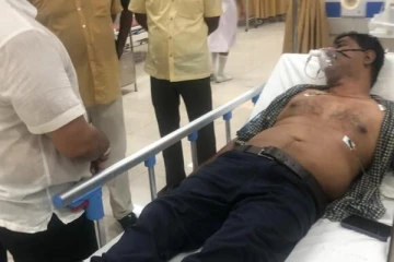 பொலிஸாரின் கண்ணீர் புகையால் எம்.பி அவசர சிகிச்சைப் பிரிவில் அனுமதி