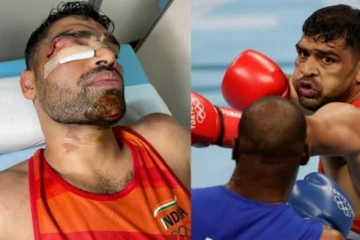 முகத்தில் 13 தையல்கள்.. சண்டை போட விரும்பிய இந்திய குத்துச்சண்டை வீரர்