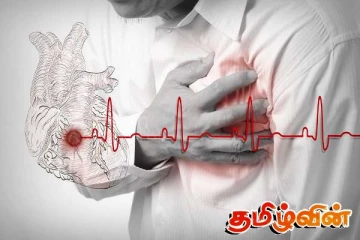 இலங்கையில் இதய நோயாளர்களின் எண்ணிக்கை அதிகரிப்பு