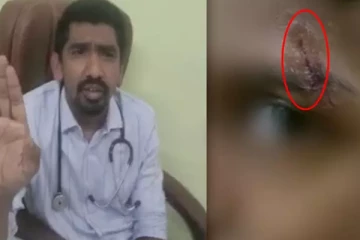 வெட்டுக்காயத்திற்கு பெவிக்குய்க் தடவி ஒட்டிய மருத்துவர் - தெலுங்கானாவில் அதிர்ச்சி சம்பவம்!