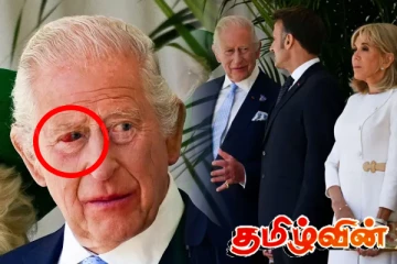 மன்னர் சார்லஸின் சிவந்த கண்..! வெளியான காரணம்