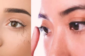 கண் இமை அடிக்கடி கொட்டுகிறதா? இந்த நோயின் அறிகுறியாகவும் இருக்கலாம்