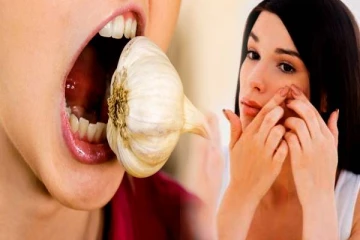 Garlic Benefits: வெறும் வயிற்றில் பூண்டு சாப்பிட்டால் முகப்பரு வராதாம்- செய்து பாருங்க!