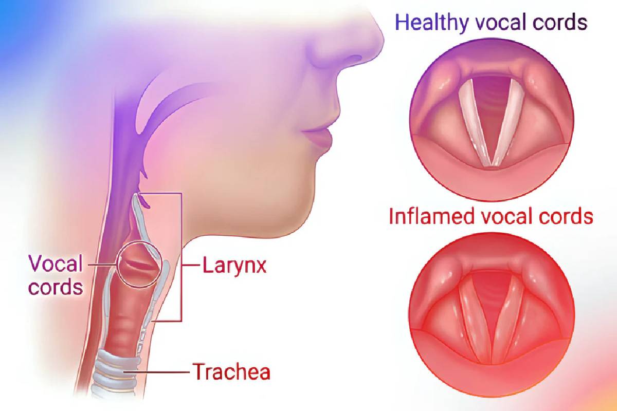 பாடகி சுஜாவிற்கு தொண்டையில் என்ன பிரச்சனை? இதை குணப்படுத்த முடியுமா? | What Problem With Singer Suja S Throat Can Cured