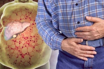 கல்லீரல் கொழுப்பை எளியமுறையில் கரைக்க வேண்டுமா? சில இயற்கை வழிகள் இதோ