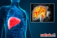 உடலில் அதிக வேலை செய்யும் உறுப்பு இதுதான்! பாதிப்பு குறித்து எச்சரிக்கும் மருத்துவர்கள்