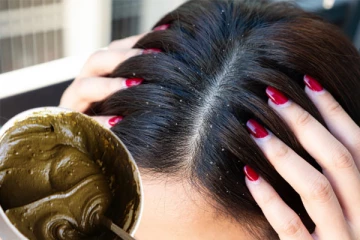 மருதாணி இருந்தால் போதும்... வந்த இடம் தெரியாமல் பொடுகு போயிடுமாம்!