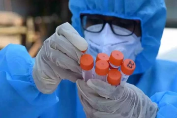 අද කොවිඩ් ආසාදිතයන් වැඩිවේ.. රට පුරා කොවිඩ්