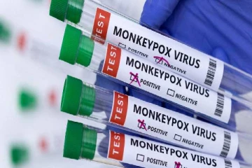 உலகிலே முதன்முறையாக குரங்கம்மையால் ஏற்பட்ட பலி