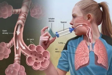 ඇදුම රෝග වර්ග අනුව ඔබට තියෙන වර්ගය හරියටම හඳුනාගන්න.