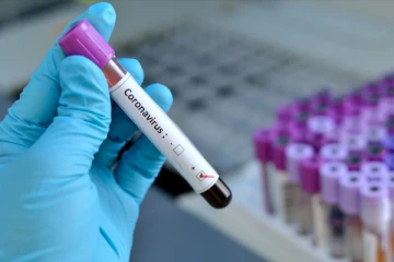 சடுதியாக அதிகரித்துள்ள கொரோனா தொற்றாளர்களின் எண்ணிக்கை