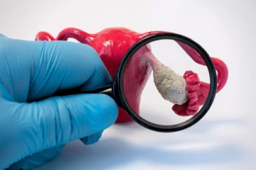 PCOD-க்கு இதுவும் ஒரு காரணமாக இருக்குமாம்! உஷாரா இருங்க!