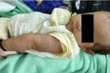 මවගේ ඇකයේ කිරි උරා බිවූ බිලිඳිය අවසන් ගමන් යැවූ කොස් ගෙඩිය..!