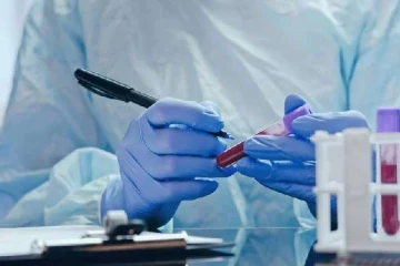 இலங்கையில் வேகமாக பரவும் வைரஸ் ; பொதுமக்கள் எச்சரிக்கையுடன் இருக்குமாறு வலியுறுத்தல்!