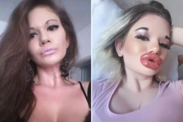 உலகின் மிகப்பெரிய உதடு கொண்ட பெண்; சாதனையை வெல்வாரா!