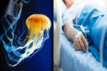 கடலில் நீராட சென்றவர்களுக்கு ஜெலி மீனால் நேர்ந்த கதி!