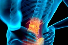 முதுகுவலி ஏன் ஏற்படுகிறது? அதற்கான தீர்வு என்ன? இத பார்த்து தெரிஞ்சிக்கோங்க ..