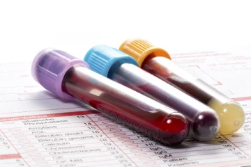 රුධිර පරීක්ෂණ වාර්තාවක් තනිවම කියවන්නේ මෙහෙමයි.