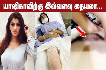 யாஷிகாவிற்கு இவ்வளவு தையலா..