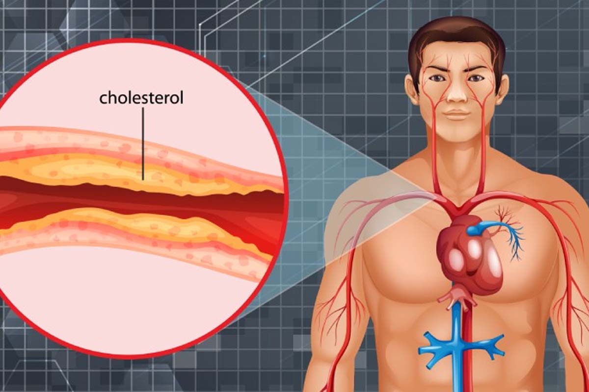 கெட்ட கொழுப்பினை அடித்து விரட்ட வேண்டுமா? பூண்டை இப்படி எடுத்துக்கோங்க | Garlic How To Help Cholesterol Control