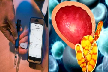 சர்க்கரை வியாதியுள்ளவர்களுக்கு பித்தப்பையில் கல் வளருமா? அறிகுறிகளும், தீர்வுகளும்