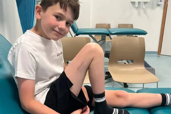 அறுவை சிகிச்சையால் தனது காலின் நீளத்தை அதிகரித்து சாதனைப் படைத்த சிறுவன் | Boy Increasing The Length Of His Leg Surgery