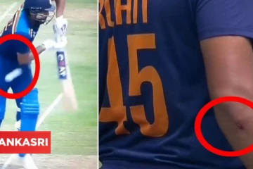 148 கிமீ வேகத்தில் பலமாக தாக்கிய பந்து.. காயமடைந்து வலியால் துடித்து போன ரோகித் சர்மா! வெளியான வீடியோ