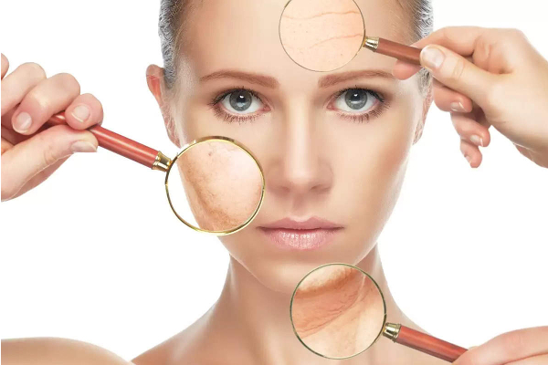 தோலின் சுருக்கங்களை போக்கக்கூடிய அற்புதமான வழி ! | Awesome Way To Get Rid Of Skin Wrinkles