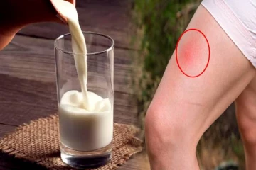 பூச்சிக் கடியை குணப்படுத்தும் பால்- எப்படின்னு தெரிஞ்சிக்கோங்க