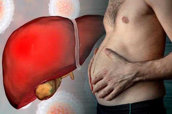 வயிறு வீக்கம்.. கல்லீரல் பாதிப்பின் தீவிரம்- இனியும் தாமதம் வேண்டாம்! | Does Liver Disease Cause A Swollen Stomach