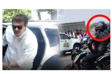 ரத்தக் காயத்துடன் வெளியான அஜீத்தின் புகைப்படம் - ஷாக்கான ரசிகர்கள் - வைரலாகும் புகைப்படம்